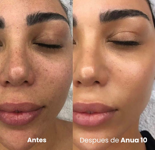 Sérum Coreano Anua 10 — Desvanece Manchas y Empareja el Tono